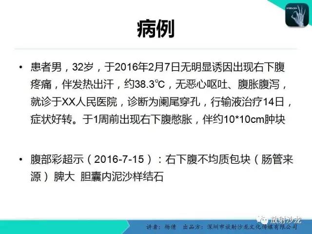 【PPT】阑尾周围脓肿