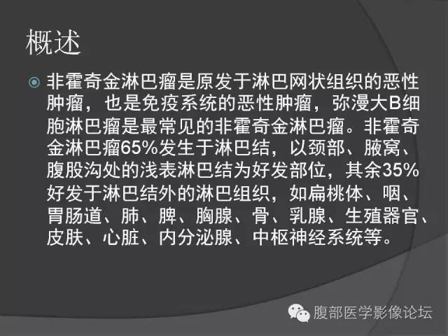 【病例】前列腺恶性淋巴瘤1例CT影像表现