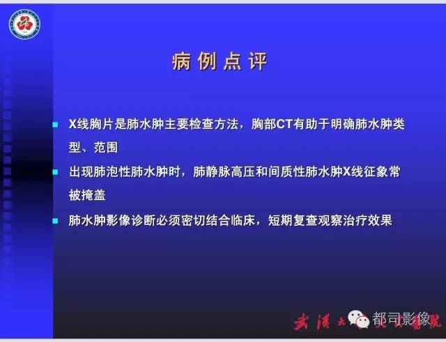 【PPT】放射科危急值影像病例点评