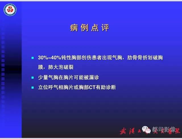 【PPT】放射科危急值影像病例点评