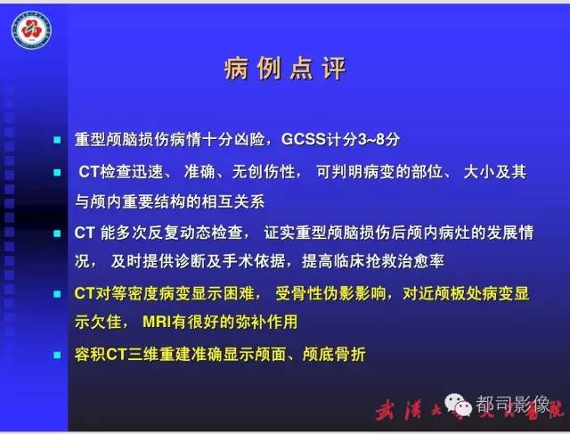 【PPT】放射科危急值影像病例点评