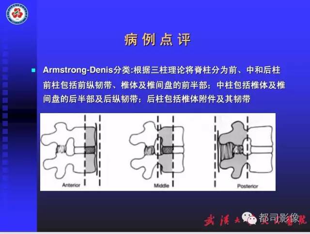 【PPT】放射科危急值影像病例点评