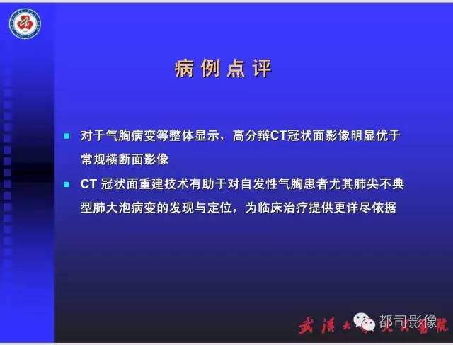 【PPT】放射科危急值影像病例点评
