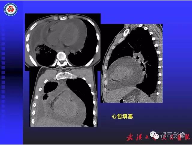 【PPT】放射科危急值影像病例点评