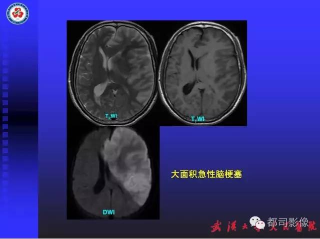 【PPT】放射科危急值影像病例点评