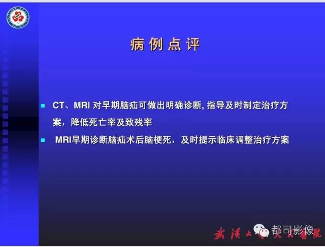 【PPT】放射科危急值影像病例点评