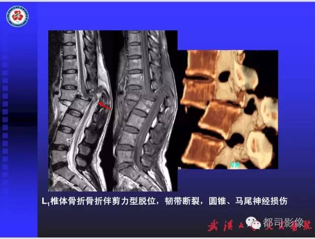 【PPT】放射科危急值影像病例点评