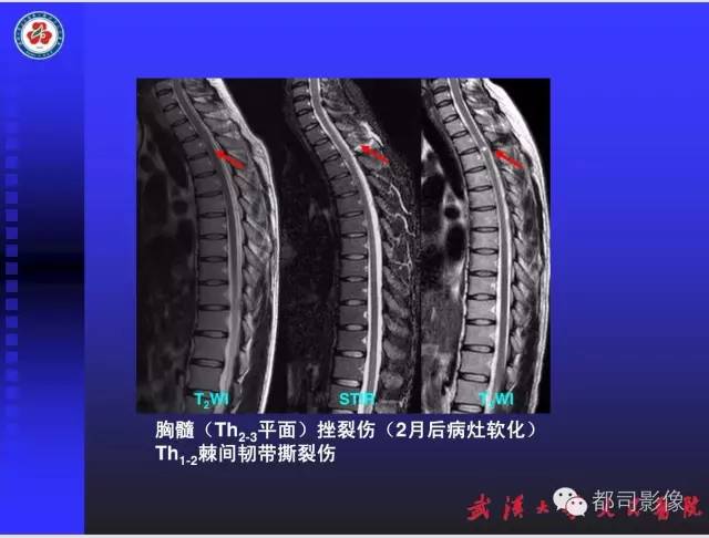 【PPT】放射科危急值影像病例点评