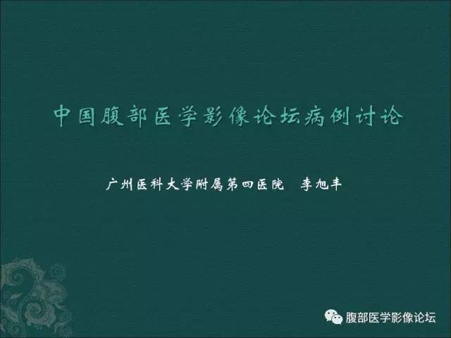 【病例】右侧肾上腺嗜铬细胞瘤1例CT