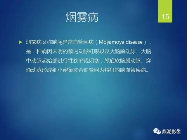 【病例】烟雾病1例CT影像表现