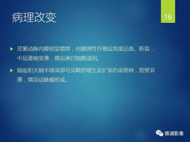 【病例】烟雾病1例CT影像表现