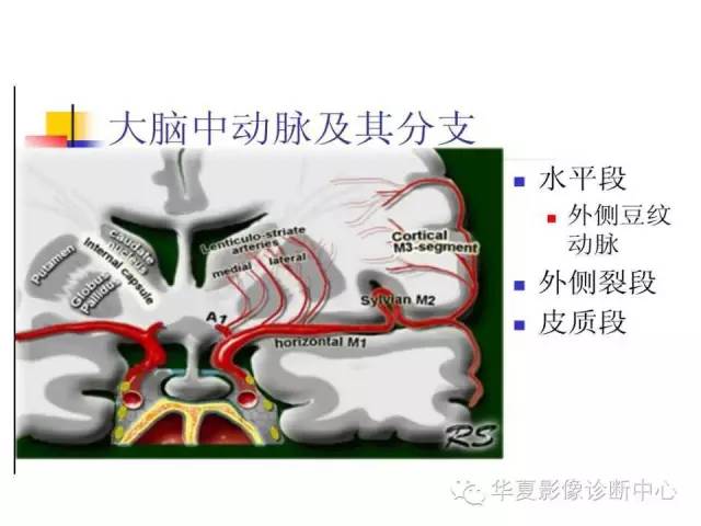 【PPT】脑小血管病
