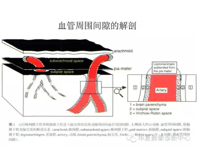 【PPT】脑小血管病