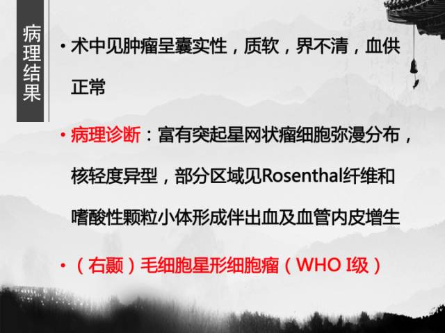【病例】毛细胞型星形细胞瘤1例MR影像表现与鉴别