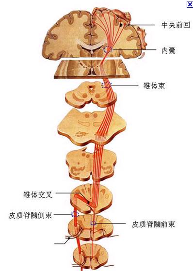 华勒氏变性的诊断要点