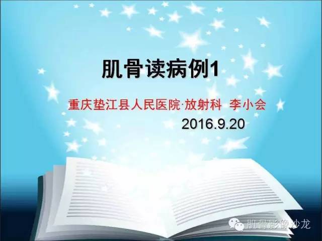 【病例】颅骨浆细胞瘤1例CT及MR