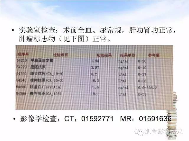 【病例】颅骨浆细胞瘤1例CT及MR