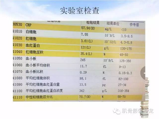 【病例】颅骨浆细胞瘤1例CT及MR