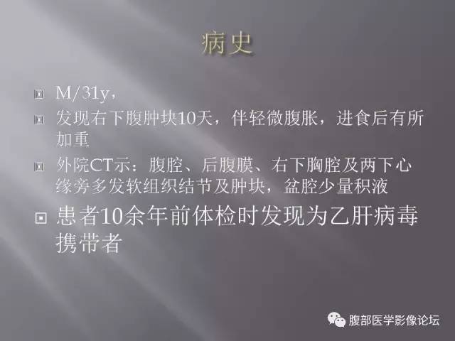 【病例】腹腔淋巴瘤1例CT影像表现