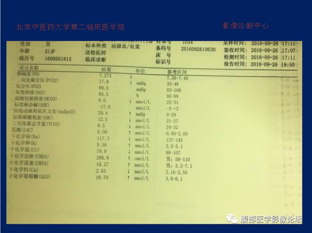 【病例】肝门静脉积气征1例CT影像表现 【病例】肝门静脉积气征1例CT影像表现
