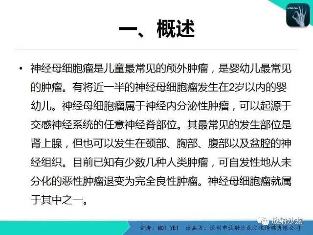 【病例】肾上腺节细胞神经瘤1例CT影像表现与鉴别