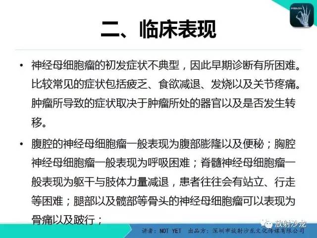 【病例】肾上腺节细胞神经瘤1例CT影像表现与鉴别