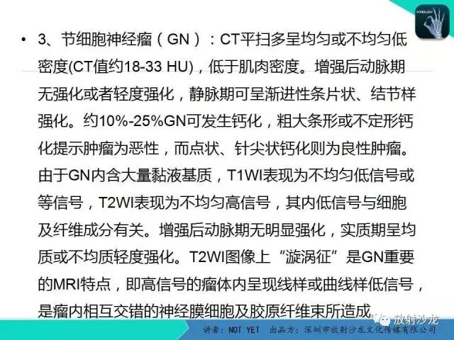 【病例】肾上腺节细胞神经瘤1例CT影像表现与鉴别
