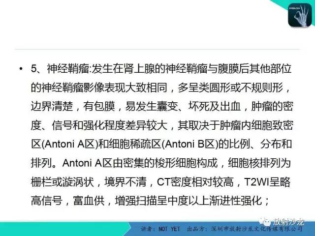 【病例】肾上腺节细胞神经瘤1例CT影像表现与鉴别