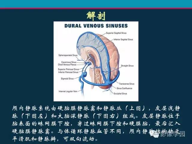 【PPT】颅脑静脉系统CT血管造影：解剖、病理及陷阱