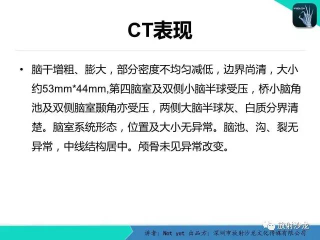 【病例】脑干胶质瘤1例MR影像表现