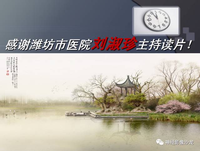 【病例】四脑室室管膜瘤1例CT及MR影像表现