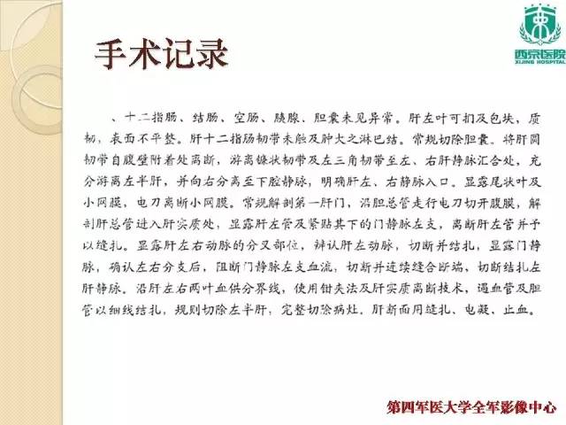 【病例】肝包虫病1例CT影像表现