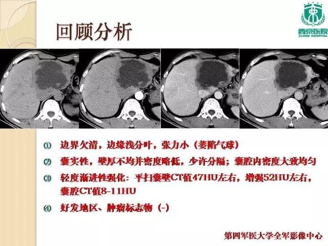 【病例】肝包虫病1例CT影像表现