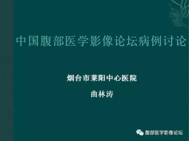 【病例】恶性腹膜间皮瘤1例CT影像表现 【病例】恶性腹膜间皮瘤1例CT影像表现