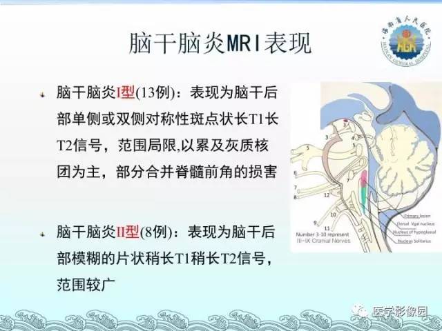 【PPT】EV71型感染手足口病合并中枢损害的影像学诊断思路