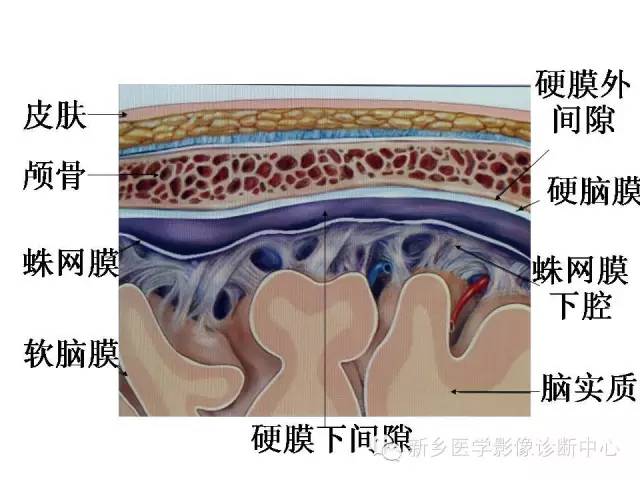 【PPT】可以引起脑膜强化的病例赏析