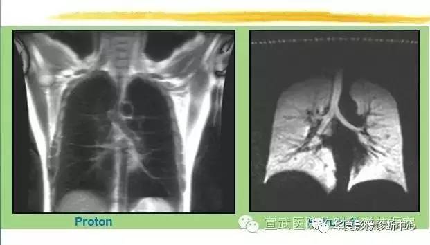 【PPT】磁共振造影剂的应用
