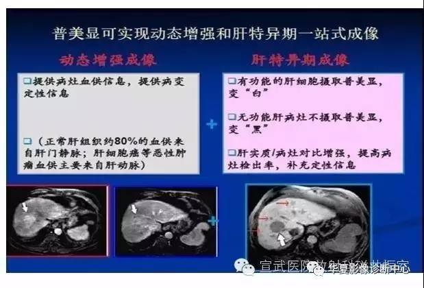 【PPT】磁共振造影剂的应用