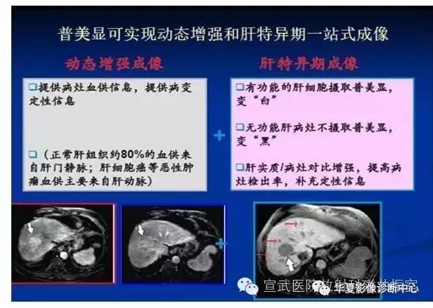 【PPT】磁共振造影剂的应用