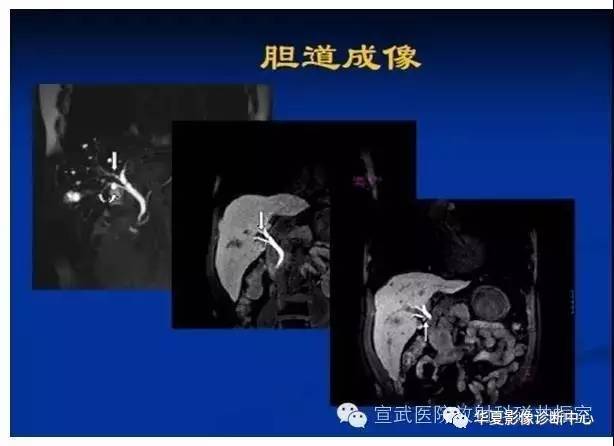 【PPT】磁共振造影剂的应用