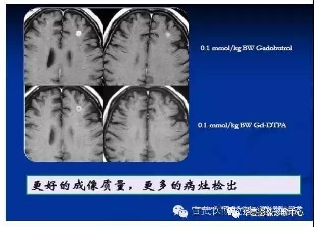 【PPT】磁共振造影剂的应用