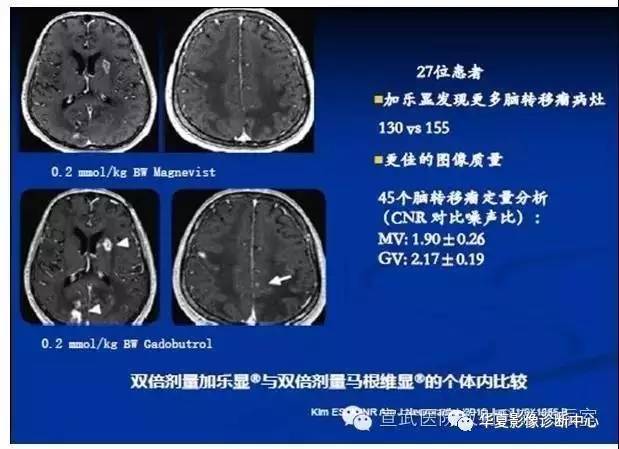 【PPT】磁共振造影剂的应用