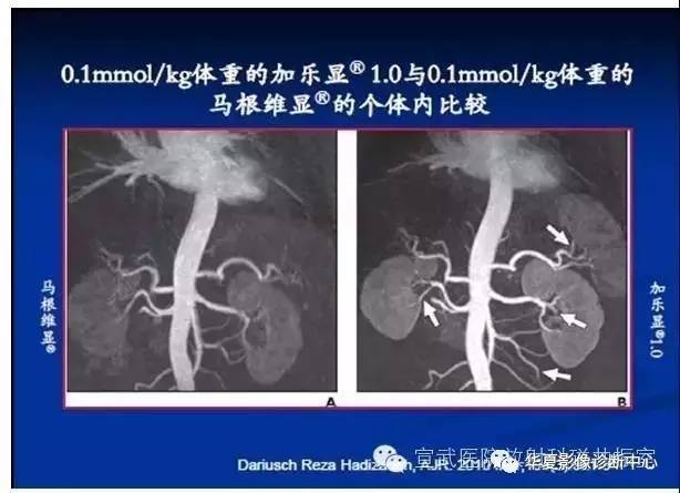 【PPT】磁共振造影剂的应用