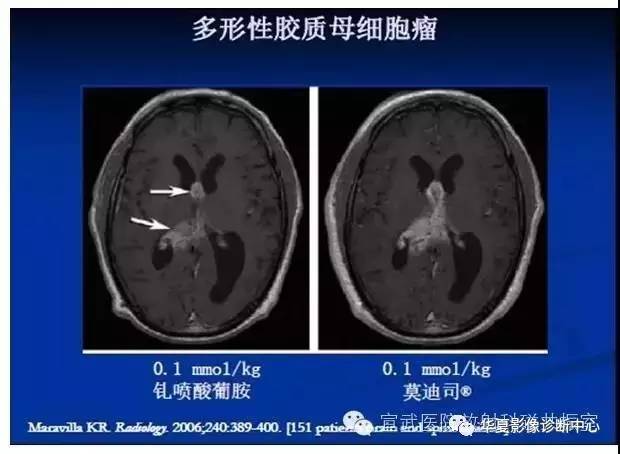 【PPT】磁共振造影剂的应用