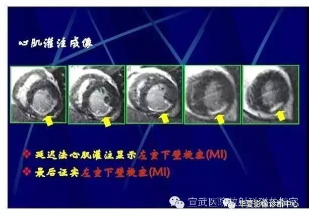 【PPT】磁共振造影剂的应用