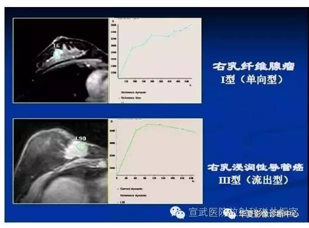 【PPT】磁共振造影剂的应用