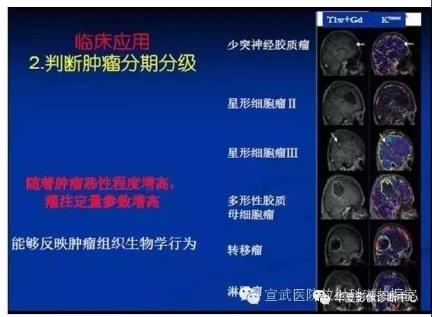 【PPT】磁共振造影剂的应用