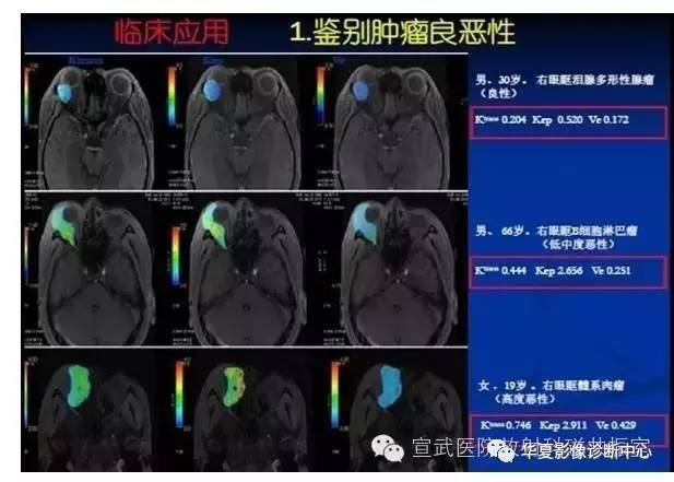 【PPT】磁共振造影剂的应用