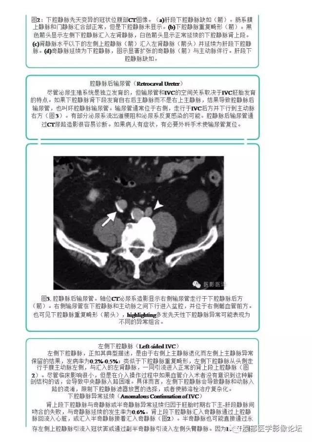 下腔静脉疾病的影像诊断