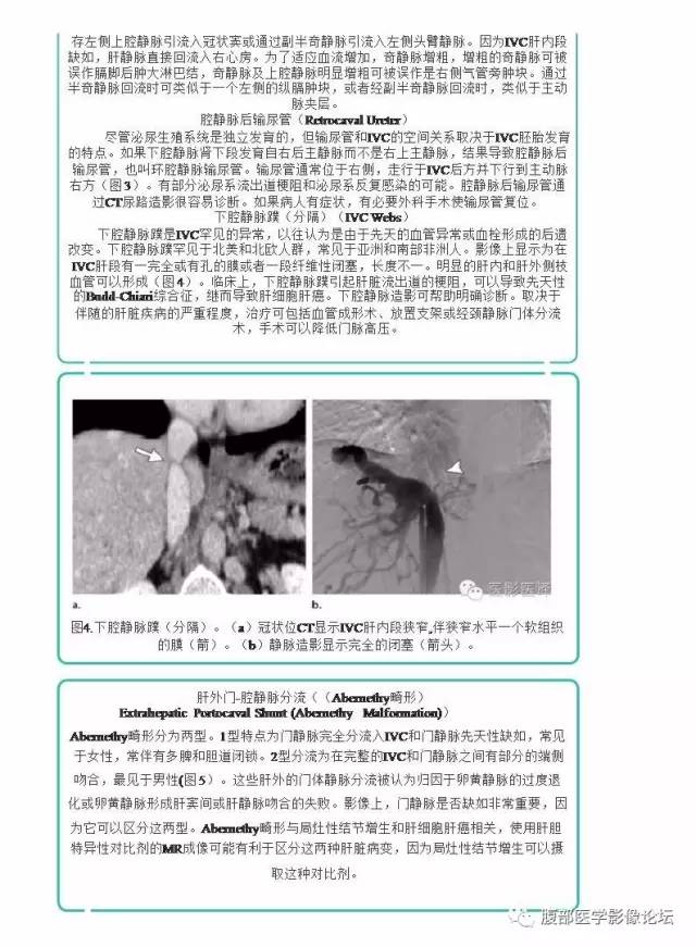 下腔静脉疾病的影像诊断